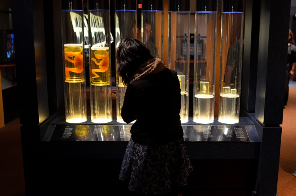 Cold, clinical, creepy. The feetal gestation timeline at Columbus, Ohio's Center Of Science & Industry.